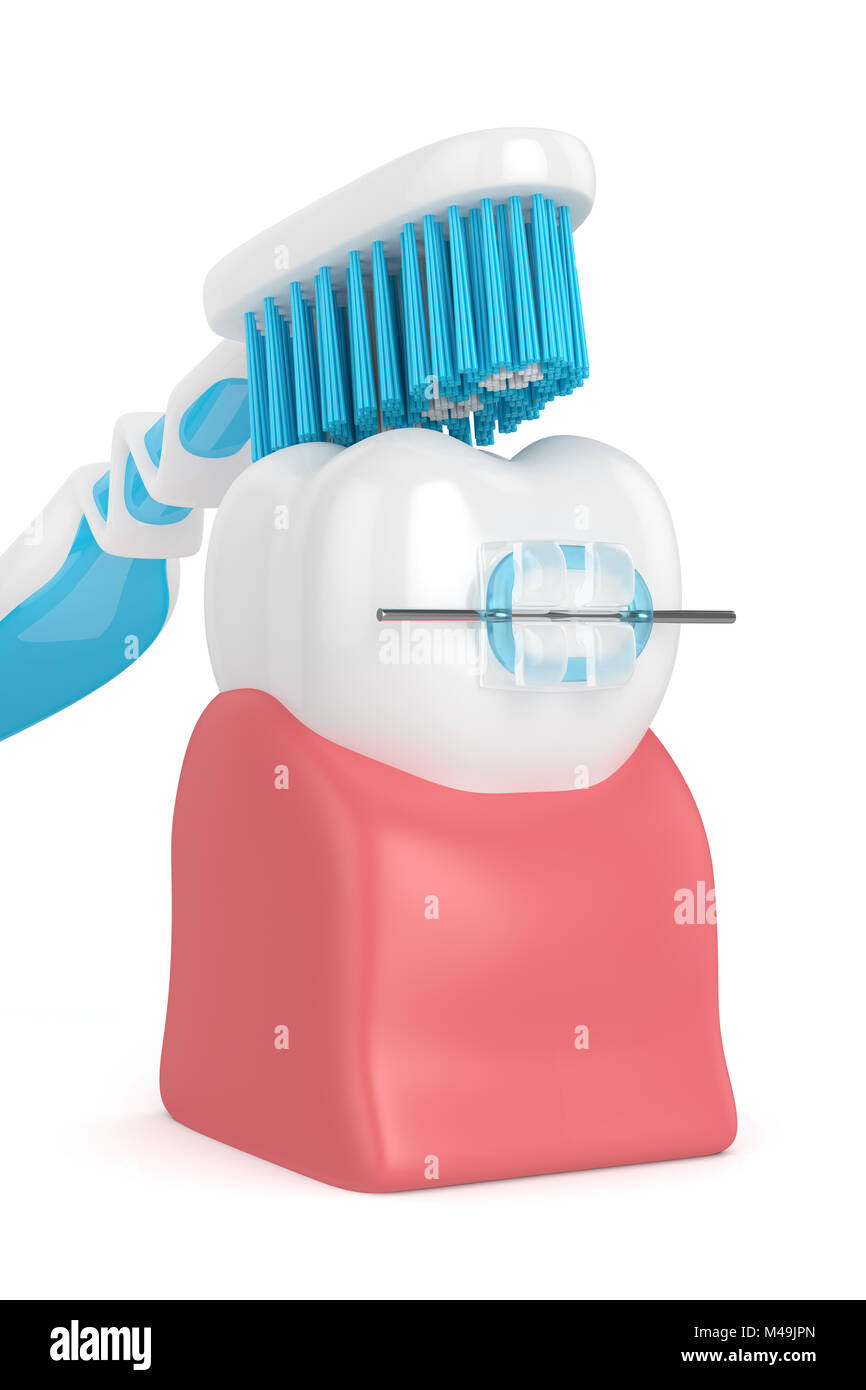 3d render of tooth with ceramic braces and toothbrush isolated over ...