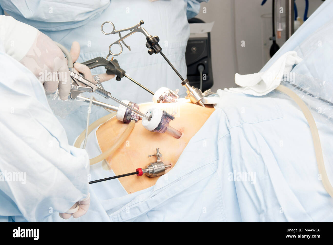 Portrait of gastric bypass surgery in hospital Stock Photo Alamy