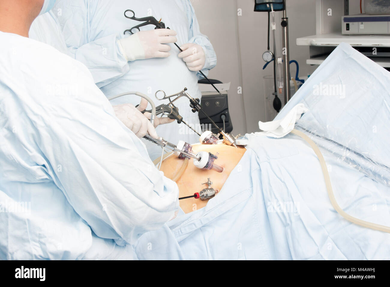 Portrait of gastric bypass surgery in hospital Stock Photo Alamy