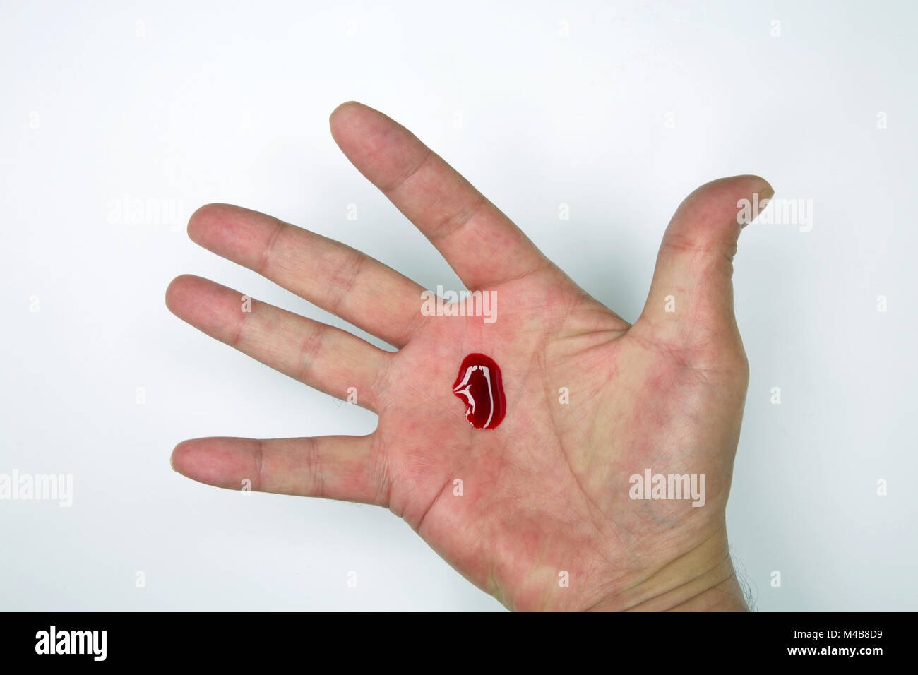 Blood On Hand Stock Photo Alamy