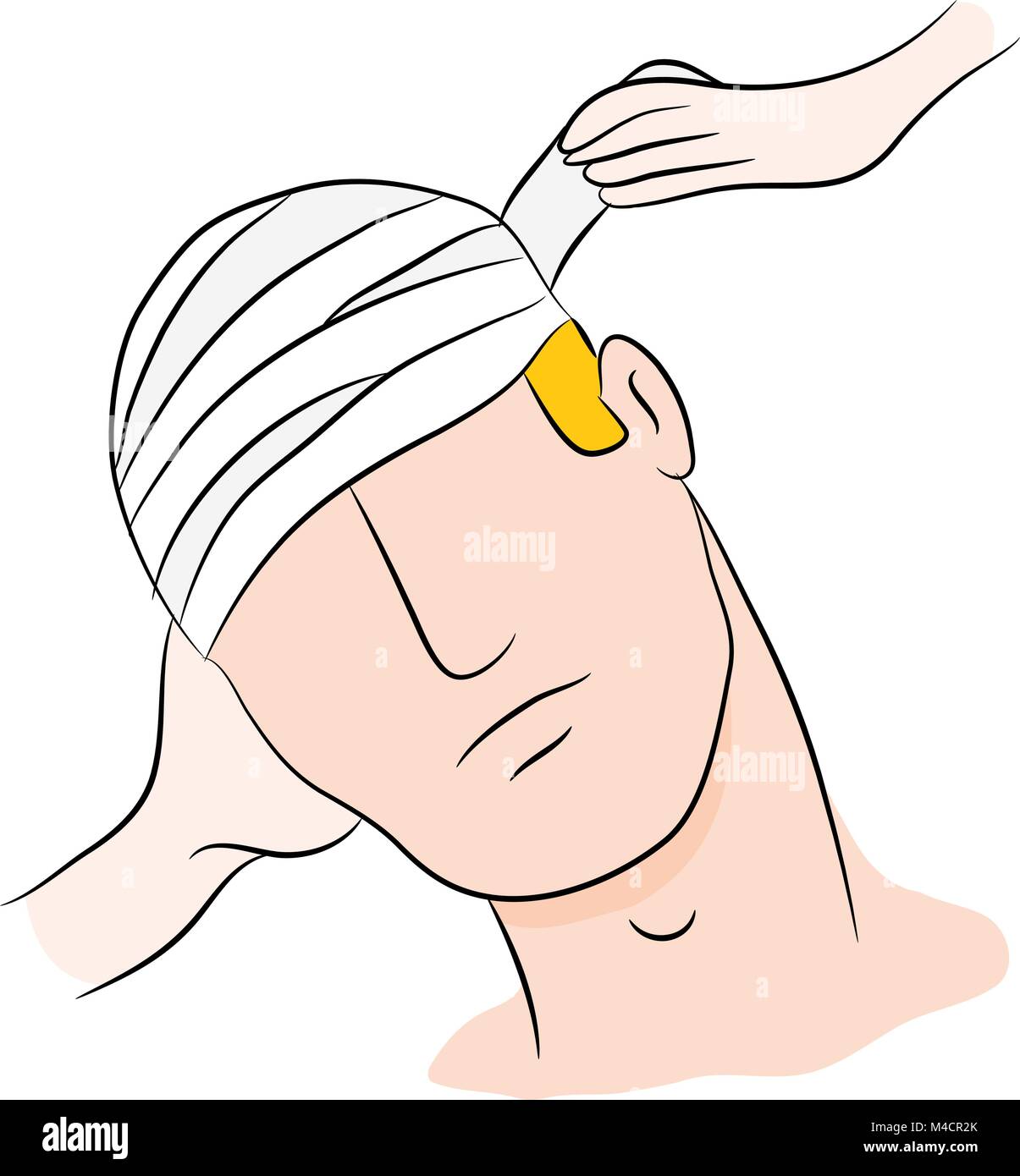 An image of a head trauma victim with bandages being wrapped. Stock Vector