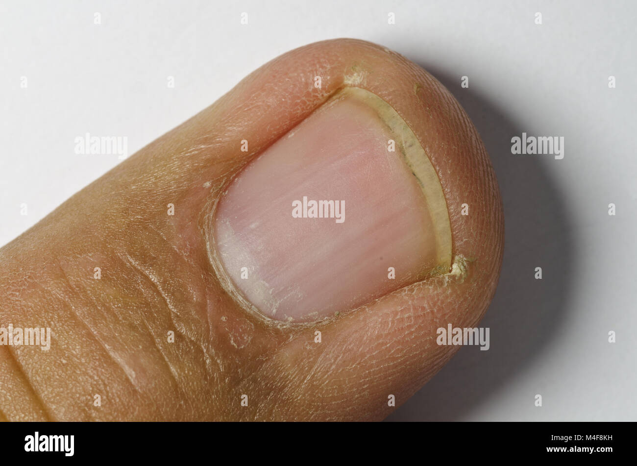 finger tip Stock Photo