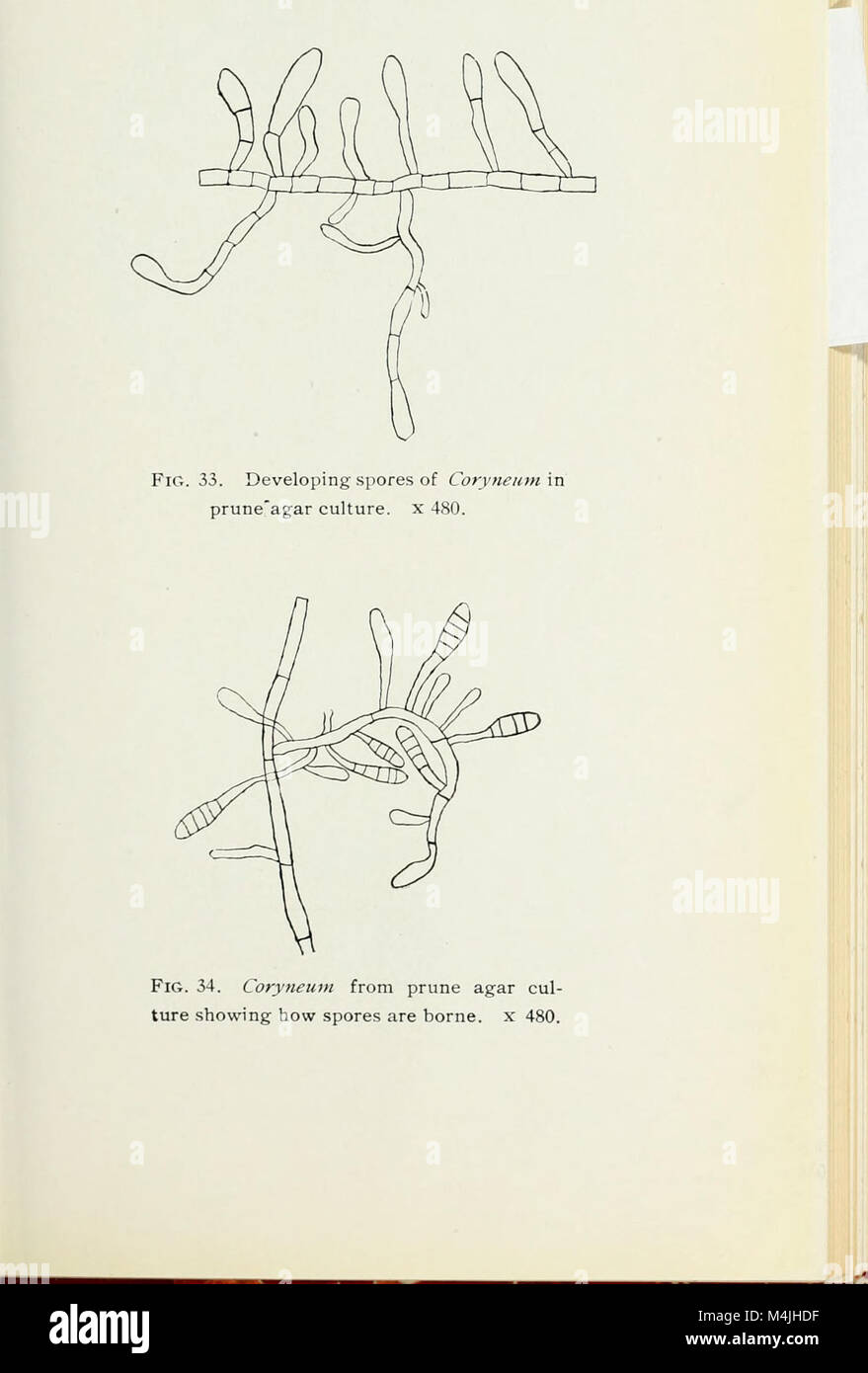 Apple diseases caused by Coryneum foliicolum and Phoma mali (1909) (19557267548) Stock Photo