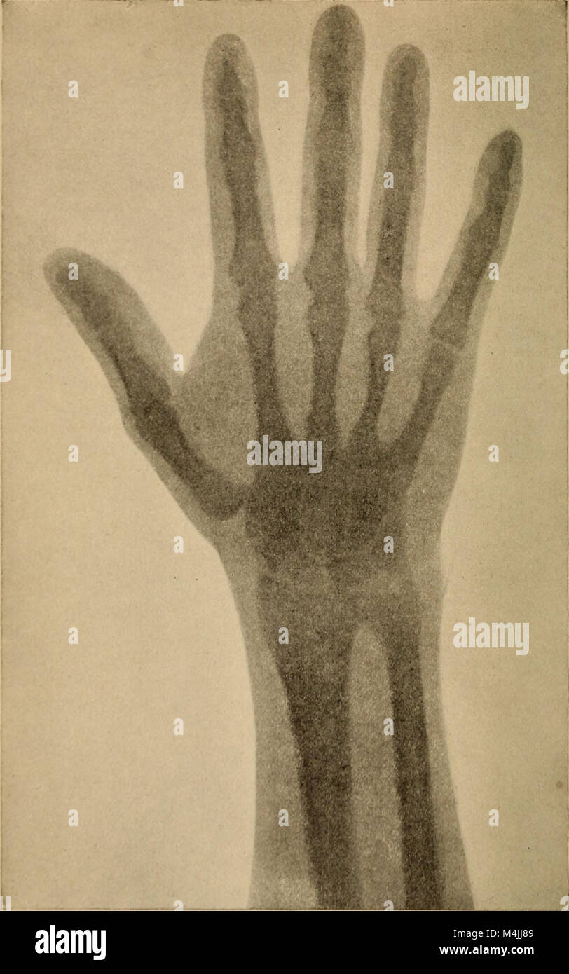 This 1897 work on applied physiology discusses the physiological effects of alcohol and narcotics on the human body. It includes detailed research on how these substances affect the nervous, cardiovascular, and respiratory systems, along with their long-term impacts on health. Stock Photo