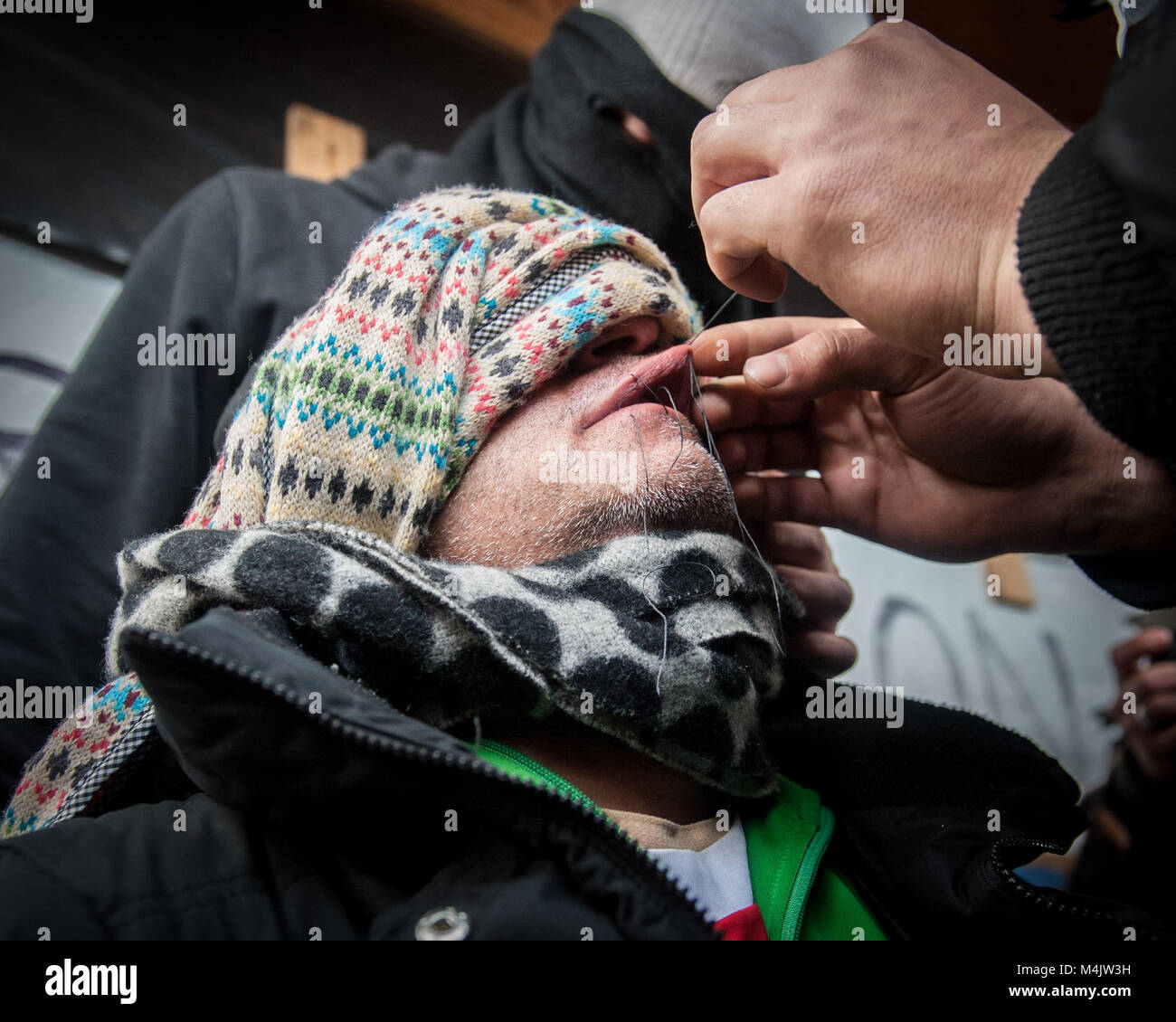 Jungle, Calais, France. 03 March, 2016. A desperate Iranian refugee has his mouth sown shut in order to signify that the voices of people living in the Calais Jungle are not being heard as the demolition continues. The man was then joined by other refugees and protested in front of riot police and bulldozers. Stock Photo