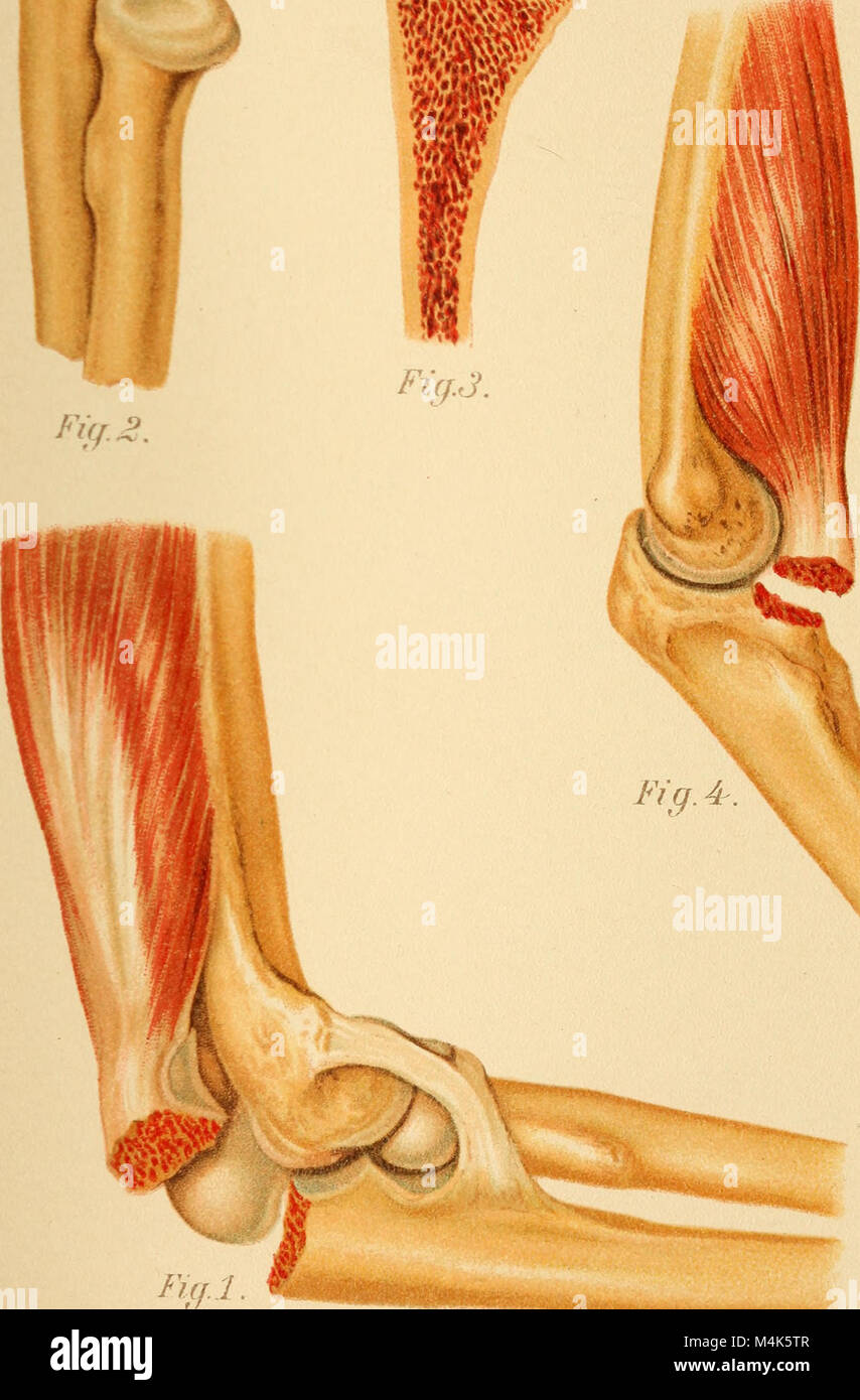 Human soft tissue anatomical research hi-res stock photography and ...