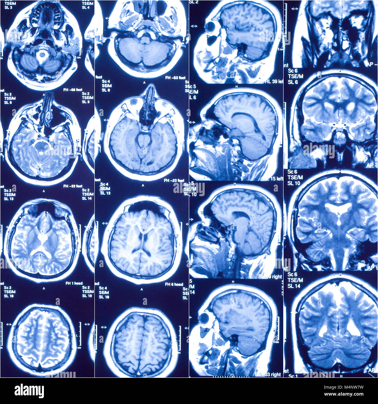 Magnetic resonance imaging, medicine concept, collage of old images Stock  Photo - Alamy