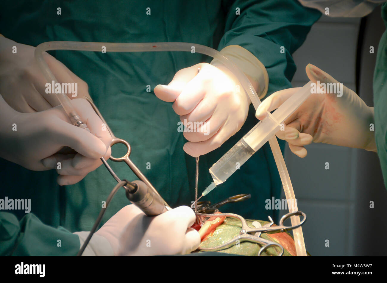 Close up view of drill, retractor, and irrigation wielded by glove encased surgical hands during cochlear implant surgical operation in temporal bone. Stock Photo