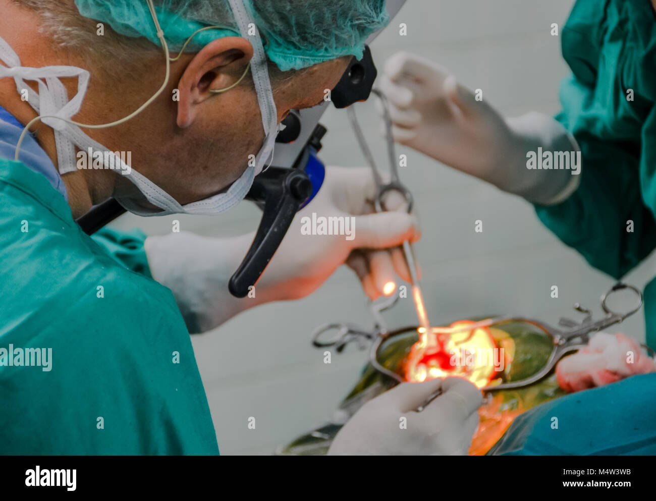 Surgeon implanting a hearing device; focus on doctor while open ear left slightly blurred and out of focus range. Stock Photo