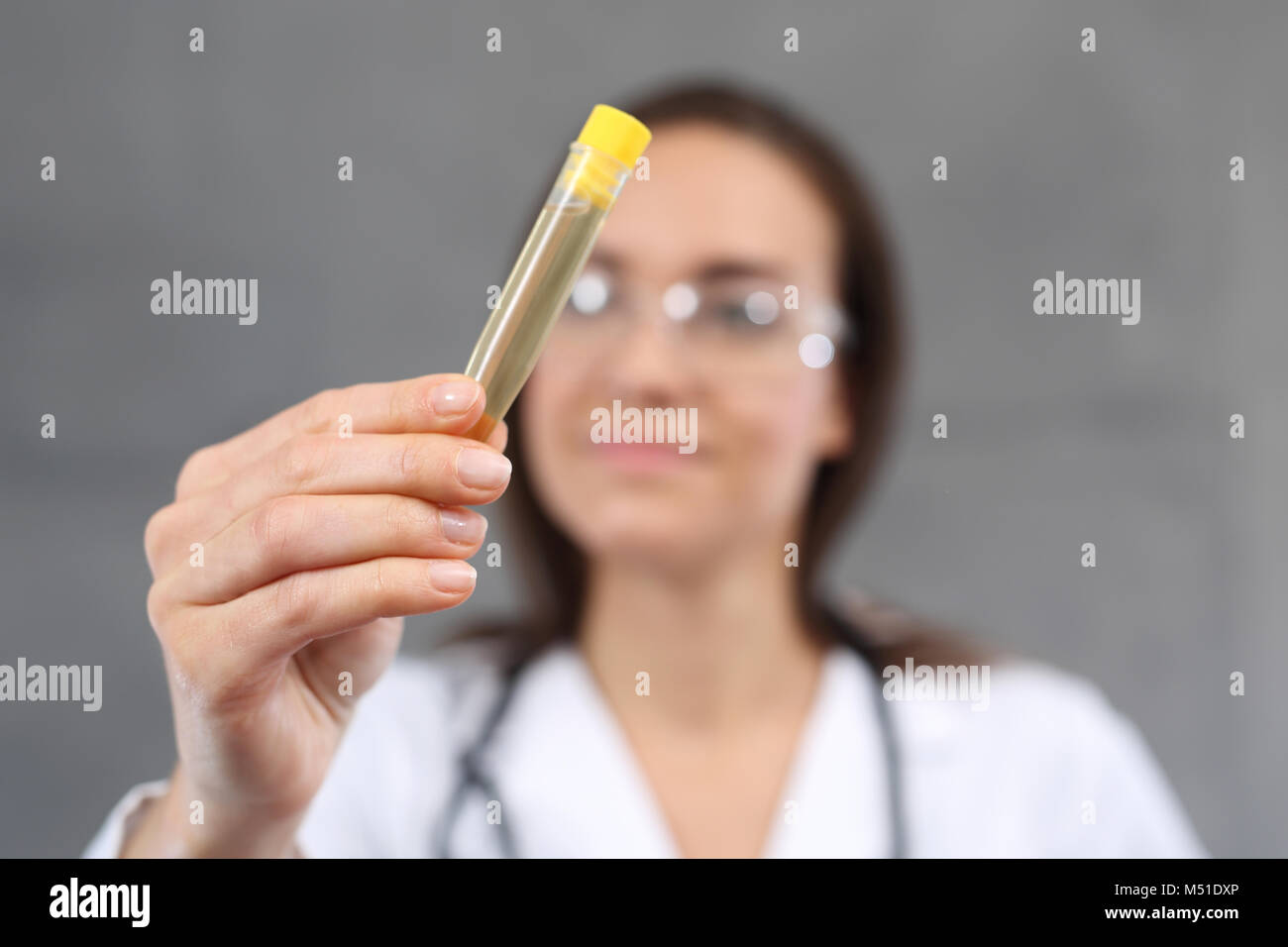 Urine test. A young laboratory woman holding a test tube with a urine