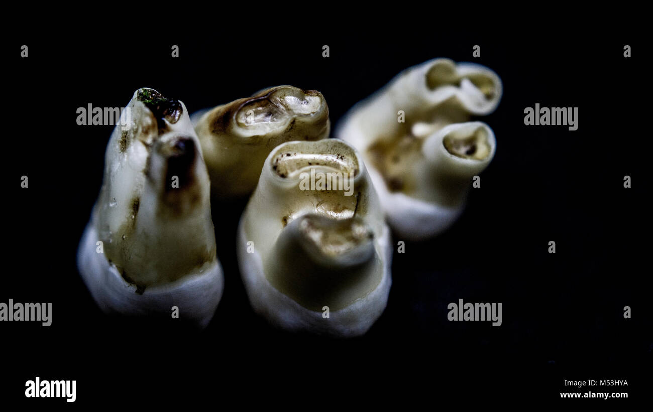 Teeth roots in Macro Stock Photo