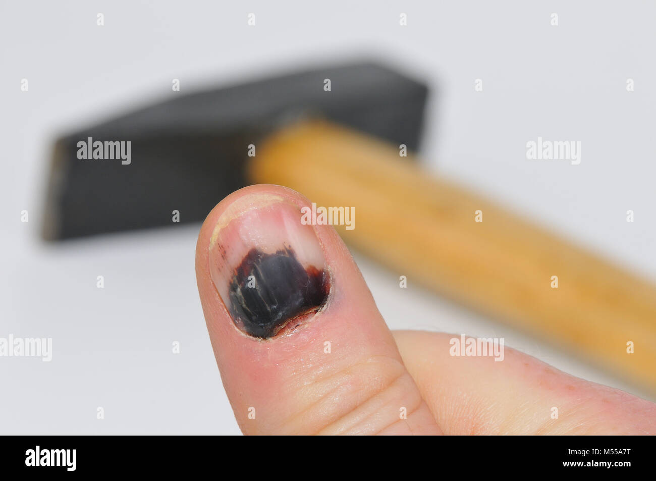 Blue fingernail and hammer Stock Photo