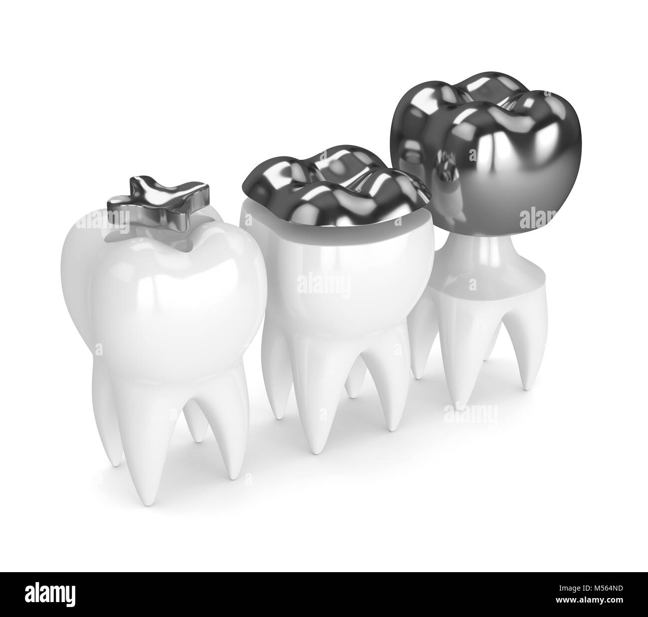 Amalgam fill dentist hires stock photography and images Alamy