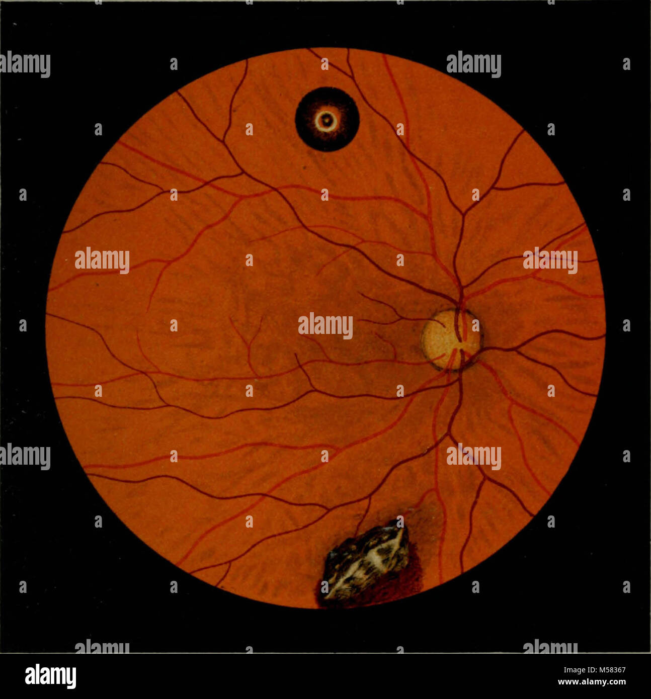 "Atlas and epitome of ophthalmoscopy and ophthalmoscopic diagnosis" (1910 Stock Photo Alamy