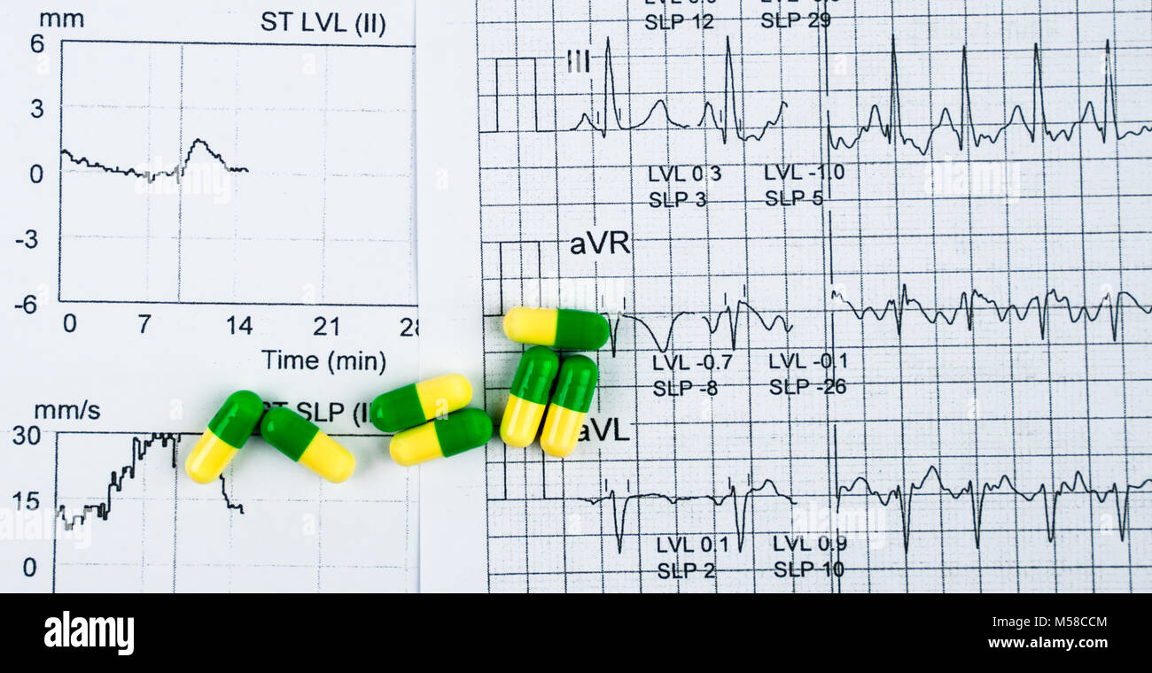 EKG or ECG (Electrocardiogram) graph report paper. EST ( Exercise Stress Test ) result and green-yellow capsule pills. Package promotion for heart che Stock Photo