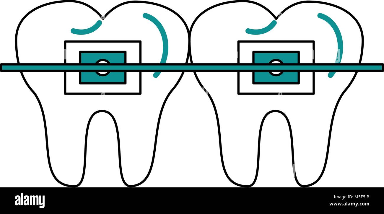 Odontology Dental Braces Stock Vector Image And Art Alamy