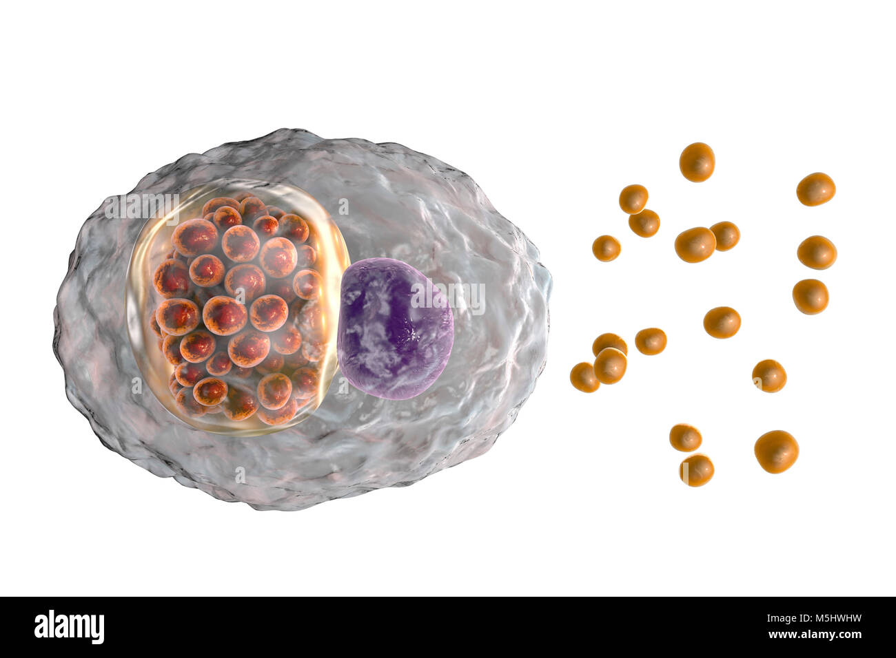 Chlamydia psittaci bacteria. Computer illustration showing two life stages of Chlamydia: elementary bodies (extracellular non-multiplying infectious stage, small orange spheres outside the cell) and an inclusion composed of a group of chlamydia reticulate bodies (intracellular multiplying stage, small orange spheres inside the cel) near the nucleus (violet) of a cell. Chlamydia species are atypical bacteria in that they are obligate intracellular parasites, living and reproducing only inside cells. This species causes abortion in animals and lung disease in humans. Stock Photo