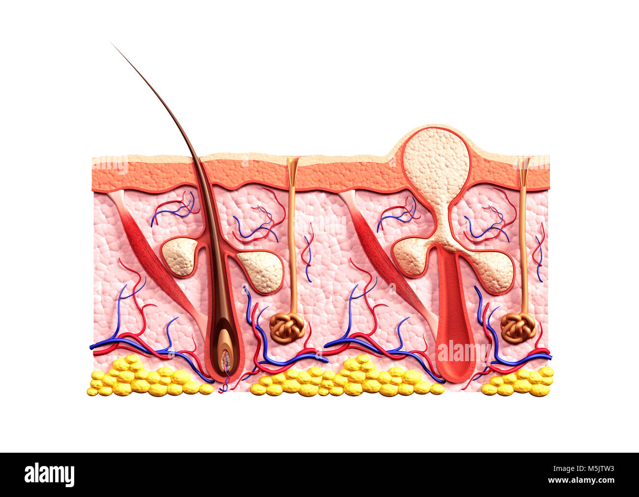 License available at MaximImages.com - Cross section of skin showing structure of a healthy hair follicle with and sebaceous glands and a whitehead Stock Photo