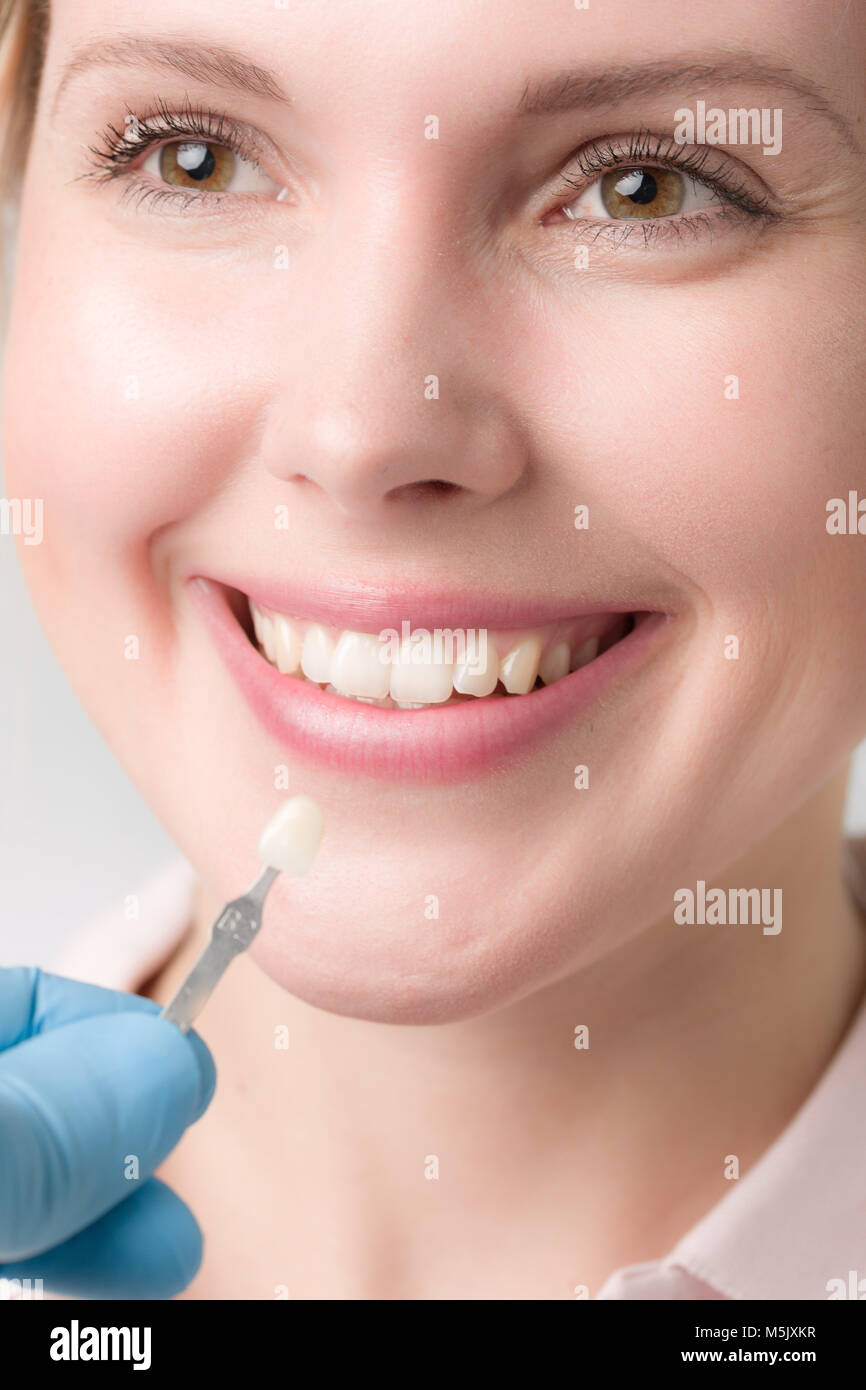 Using shade guide at mouth to check veneer of tooth crown Stock Photo