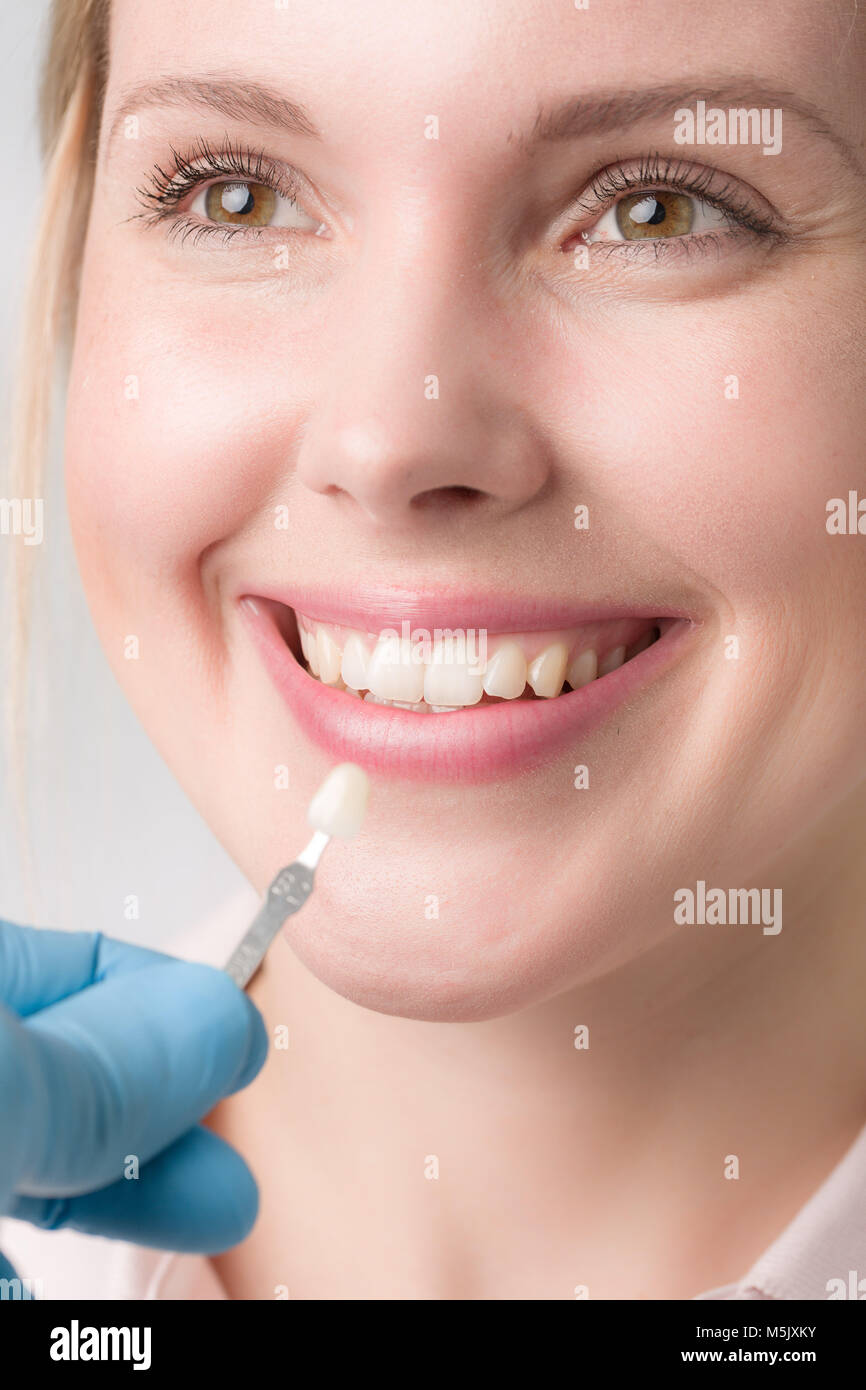 Using shade guide at mouth to check veneer of tooth crown Stock Photo