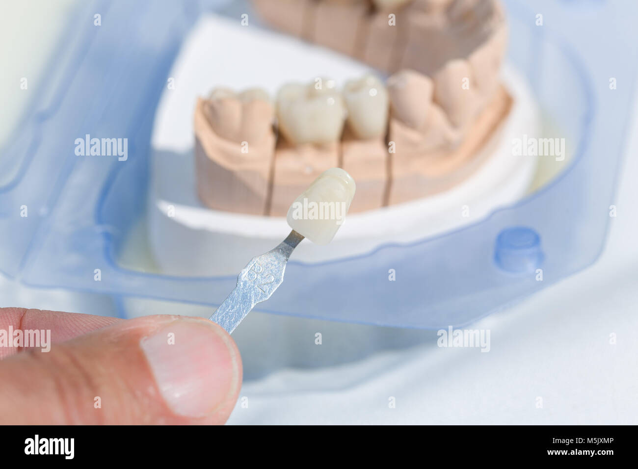 A prosthesis saddle with artificial dentition in a dental laboratory Stock Photo