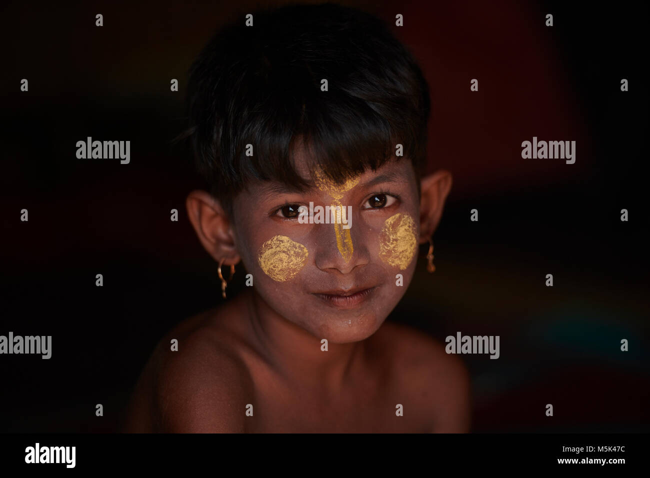 A Rohingya girl in the Jamtoli Refugee Camp near Cox's Bazar, Bangladesh. Her face is marked with thanakha, a traditional Burmese cosmetic. Stock Photo