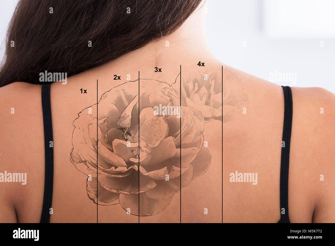 Cosmetic Dermatology I Laser Tattoo Removal I Hair Removal  San Antonio  Dermatology