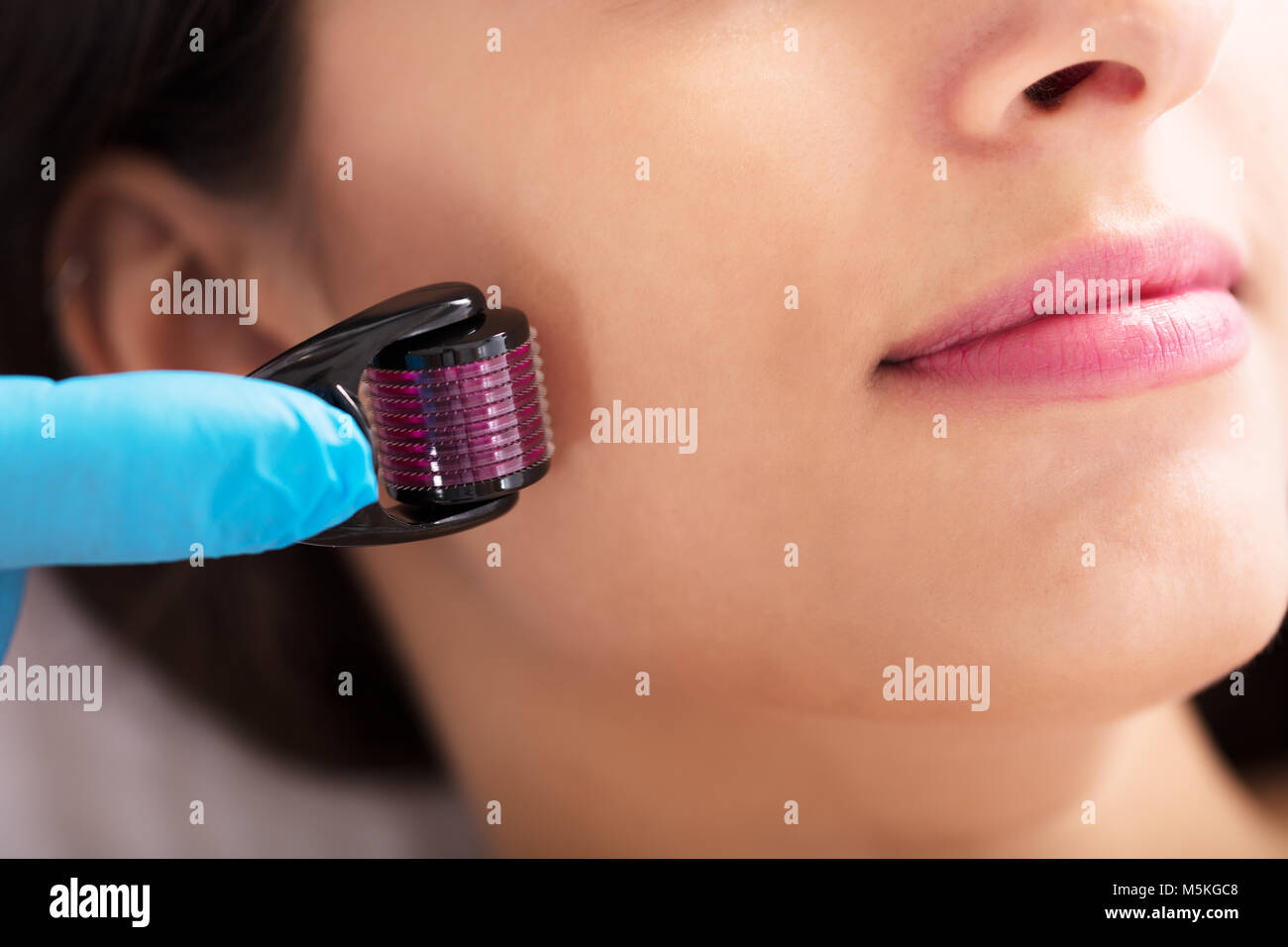 Close-up Of A Woman Having Facial Treatment On Her Face In Beauty Salon Stock Photo