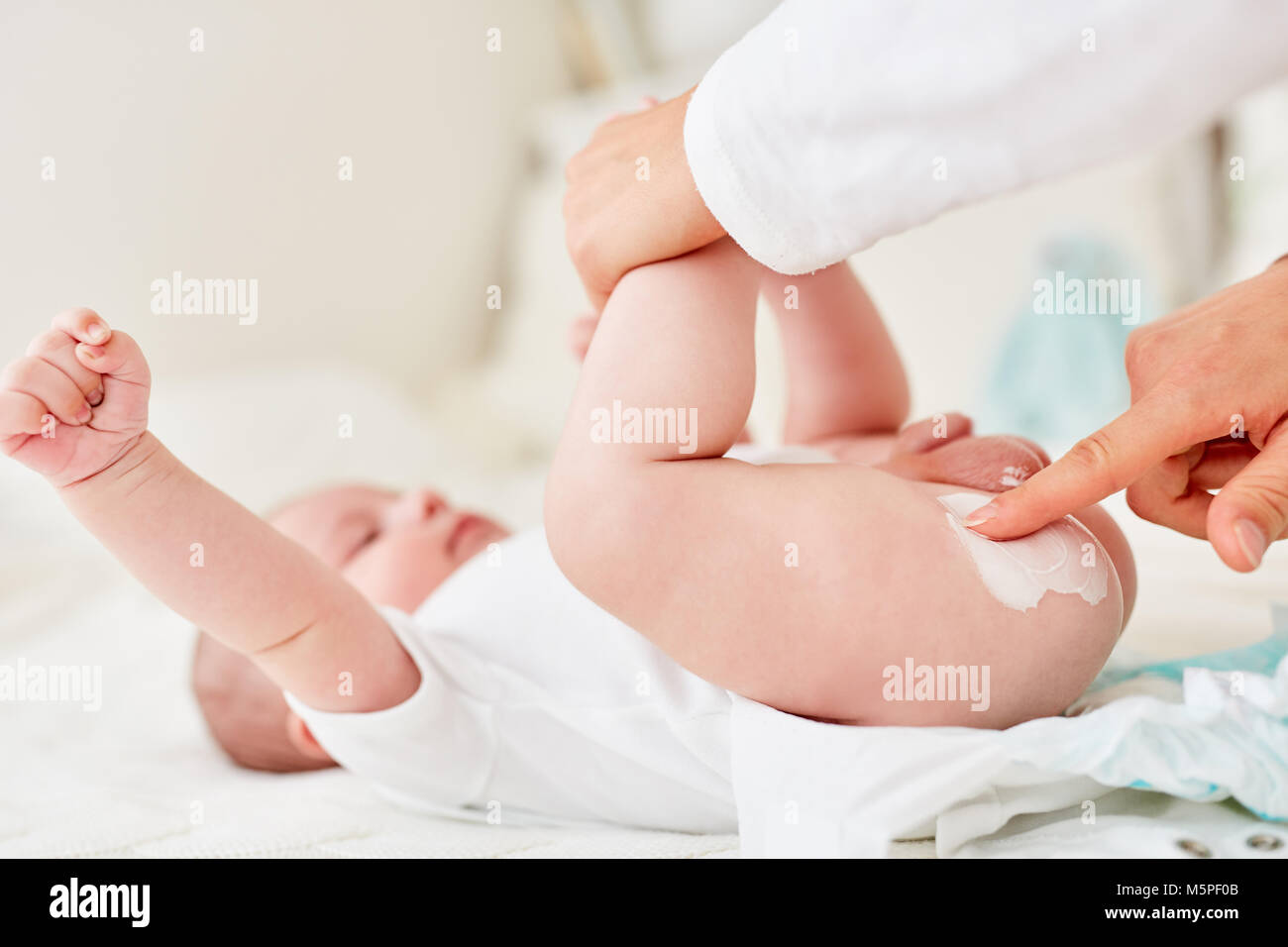 Mother creams the buttocks of an infant as a precaution against intertrigo Stock Photo