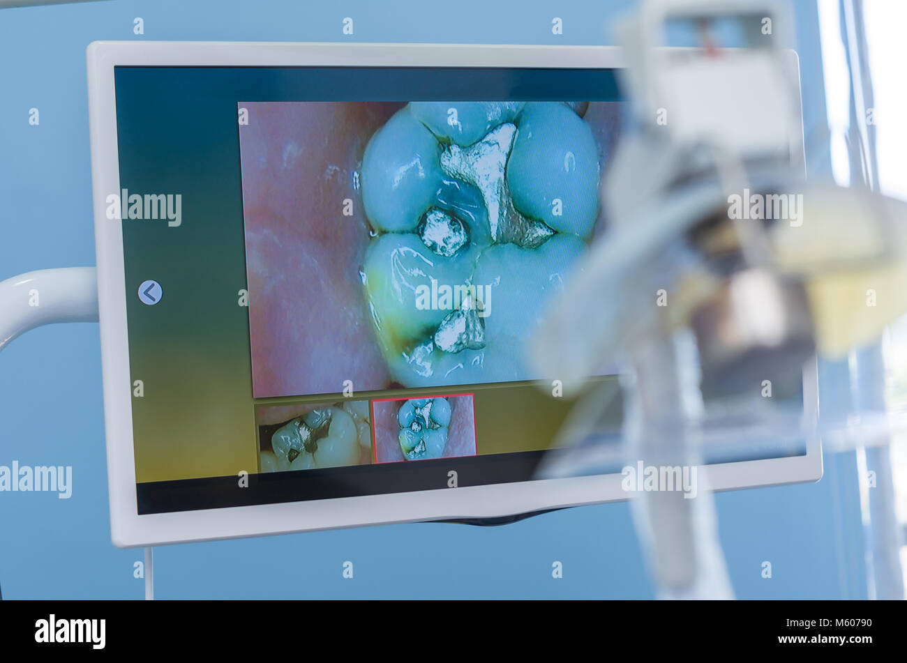 Great concept of dental procedure, Brazilian woman in the dental chair