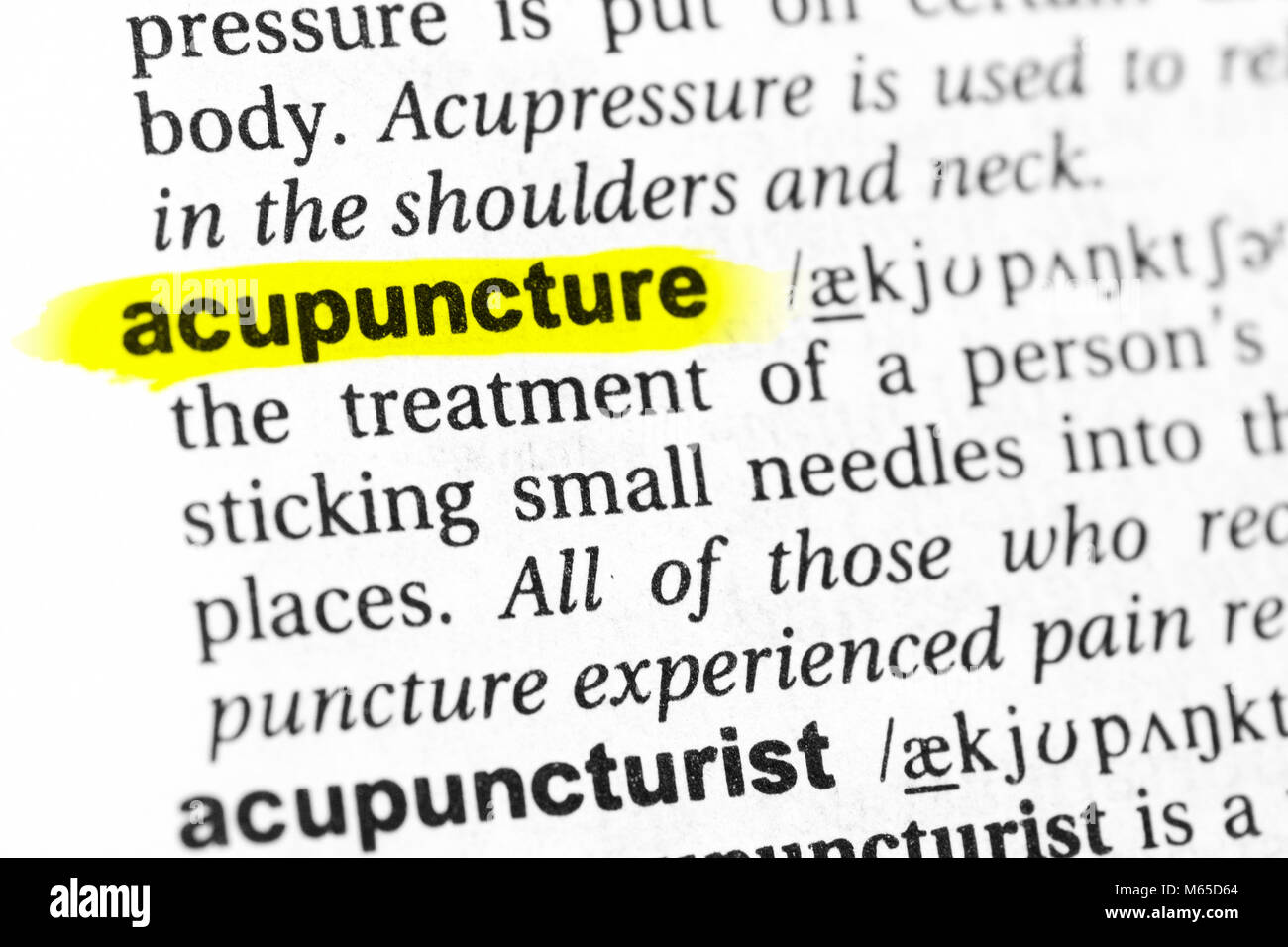 Acupuncture Short Definition at Stephan Martinez blog