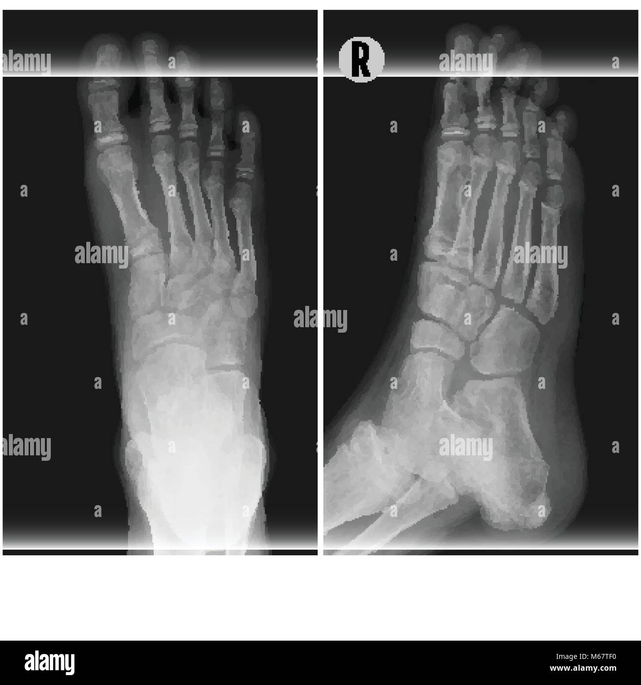 Human foot ankel and leg xray vector illustration. Top and right scan  process Stock Vector Image & Art - Alamy