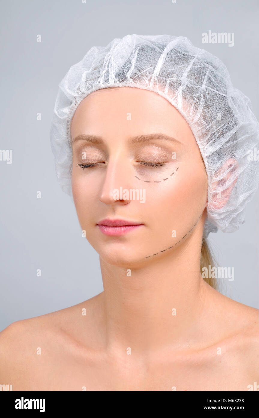 Plastic surgery. Woman with perforation lines on the face. Anti-aging