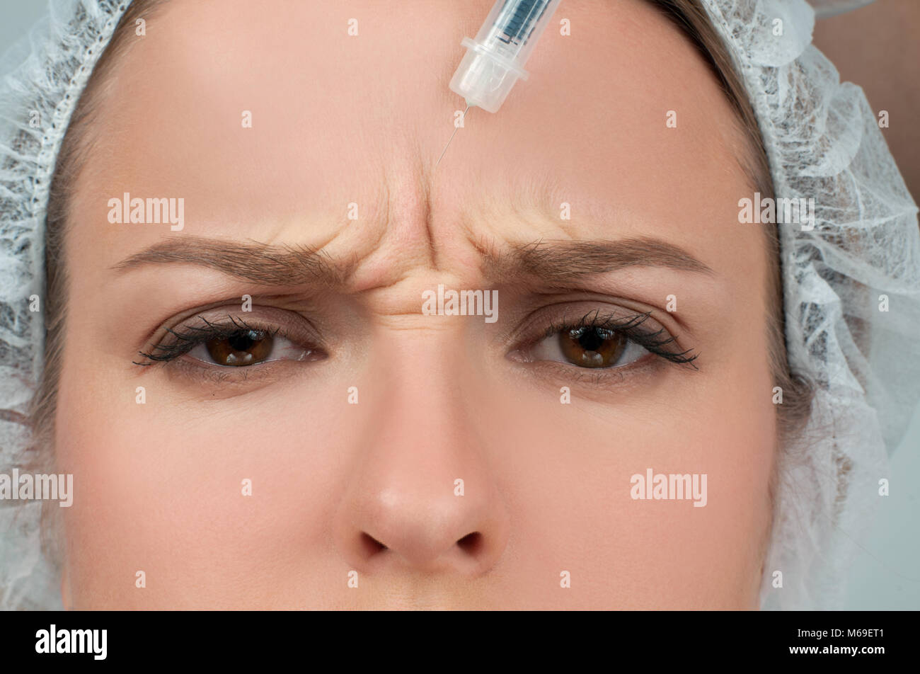 Forehead Lift High Resolution Stock Photography And Images Alamy