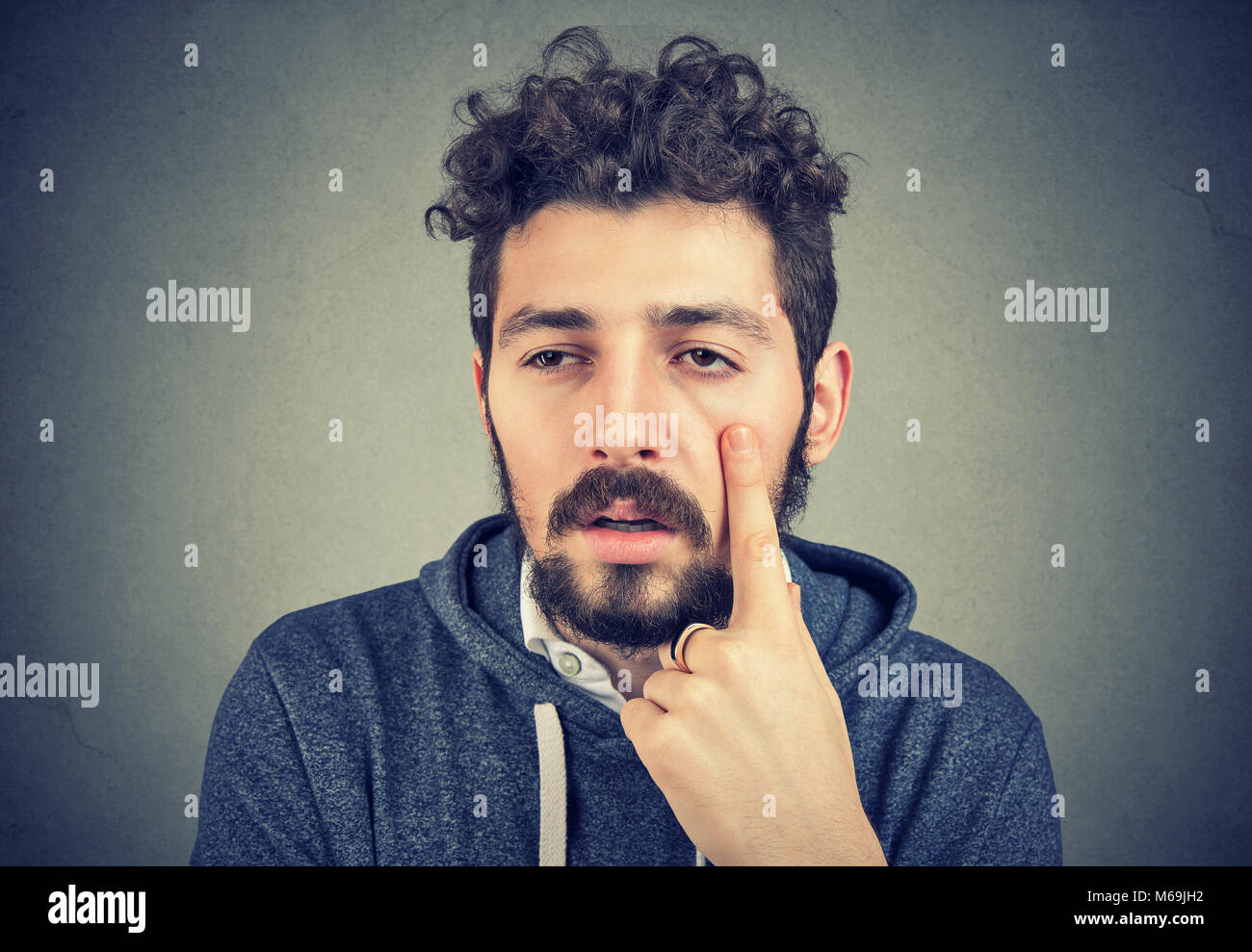 Young bearded man having puffy eyes and sick after sleepless night. Stock Photo