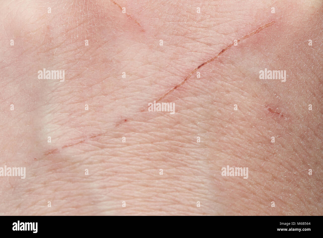 Cut from cat on human skin macro close up Stock Photo