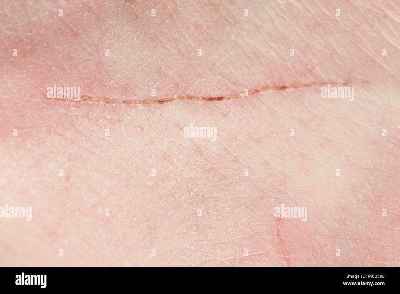 Long cut scratch on human skin macro close up Stock Photo - Alamy