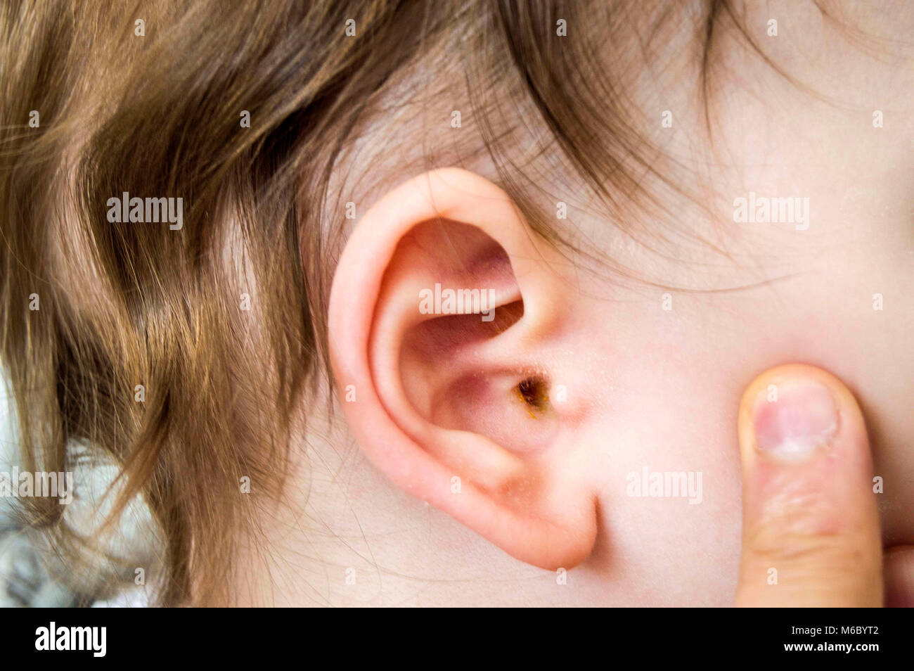 ear pictures, baby ears and ear disorders, doctor doing ear control