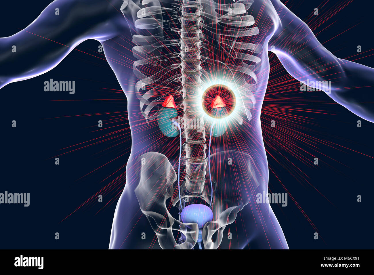 Treatment of adrenal gland disease, conceptual illustration. Stock Photo