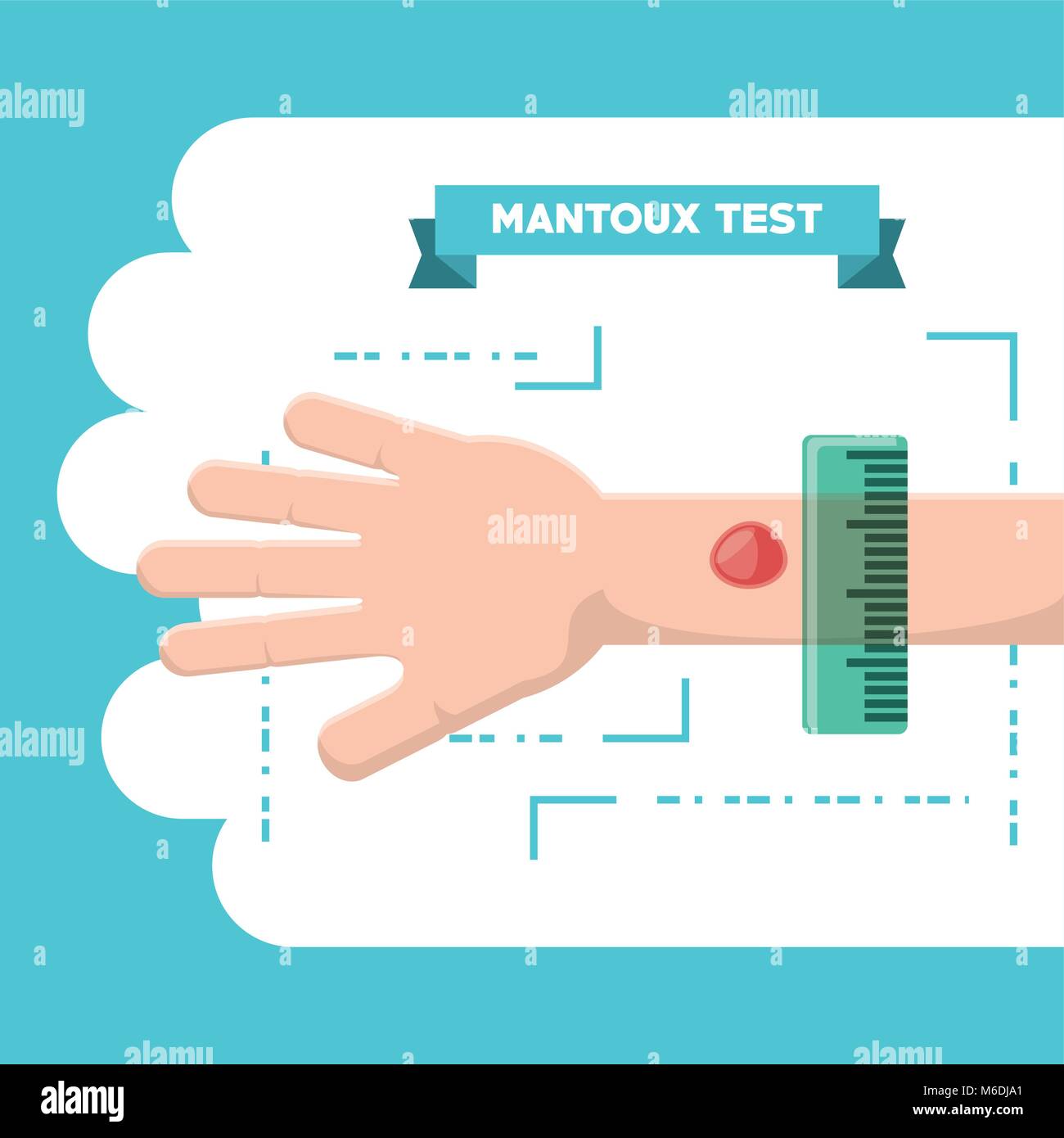 Mantoux test design with hand and injection over blue and white background, colorful design vector illustration Stock Vector