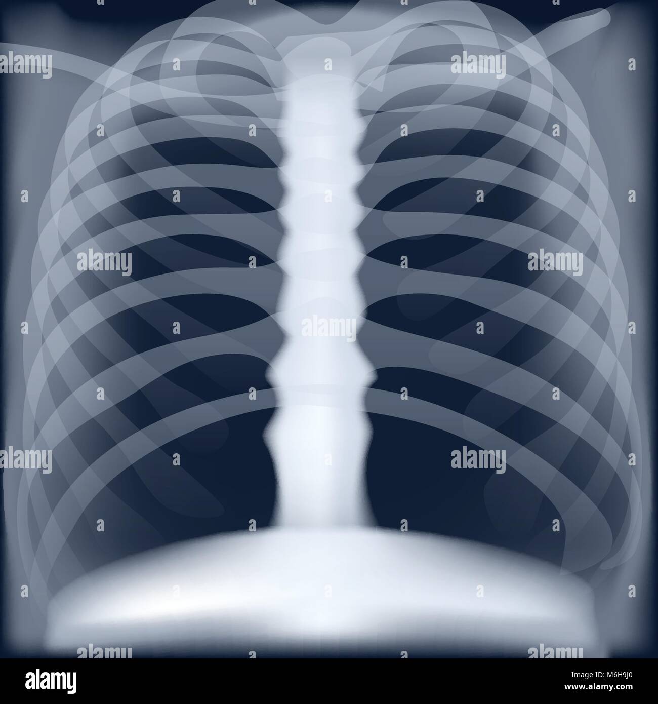 xray medical image of chest Stock Vector