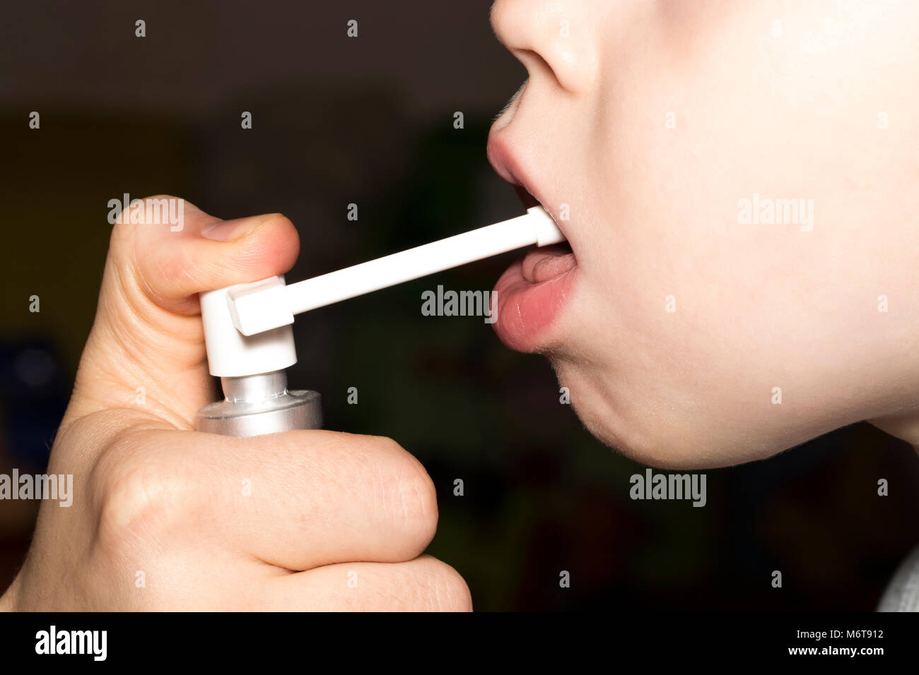 Baby Getting Medicine Through Oral Spray For Sore Throat Mother Or Doctor Treats Her Child S Throat Stock Photo Alamy