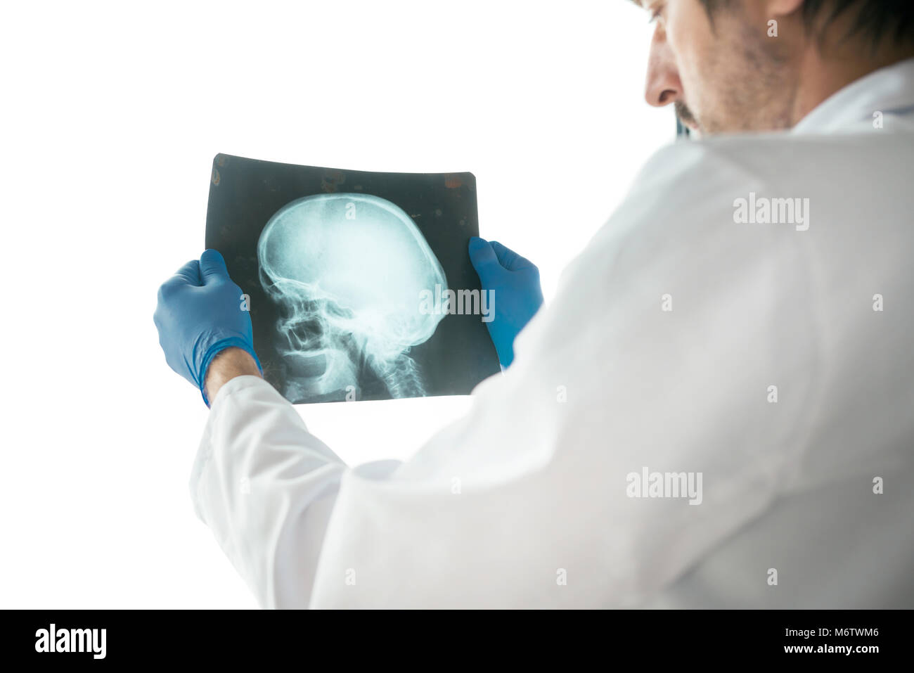 Doctor examining x-ray of the patient's skull in a medical clinic. Healthcare professional analyzing imaging test of human head. Stock Photo