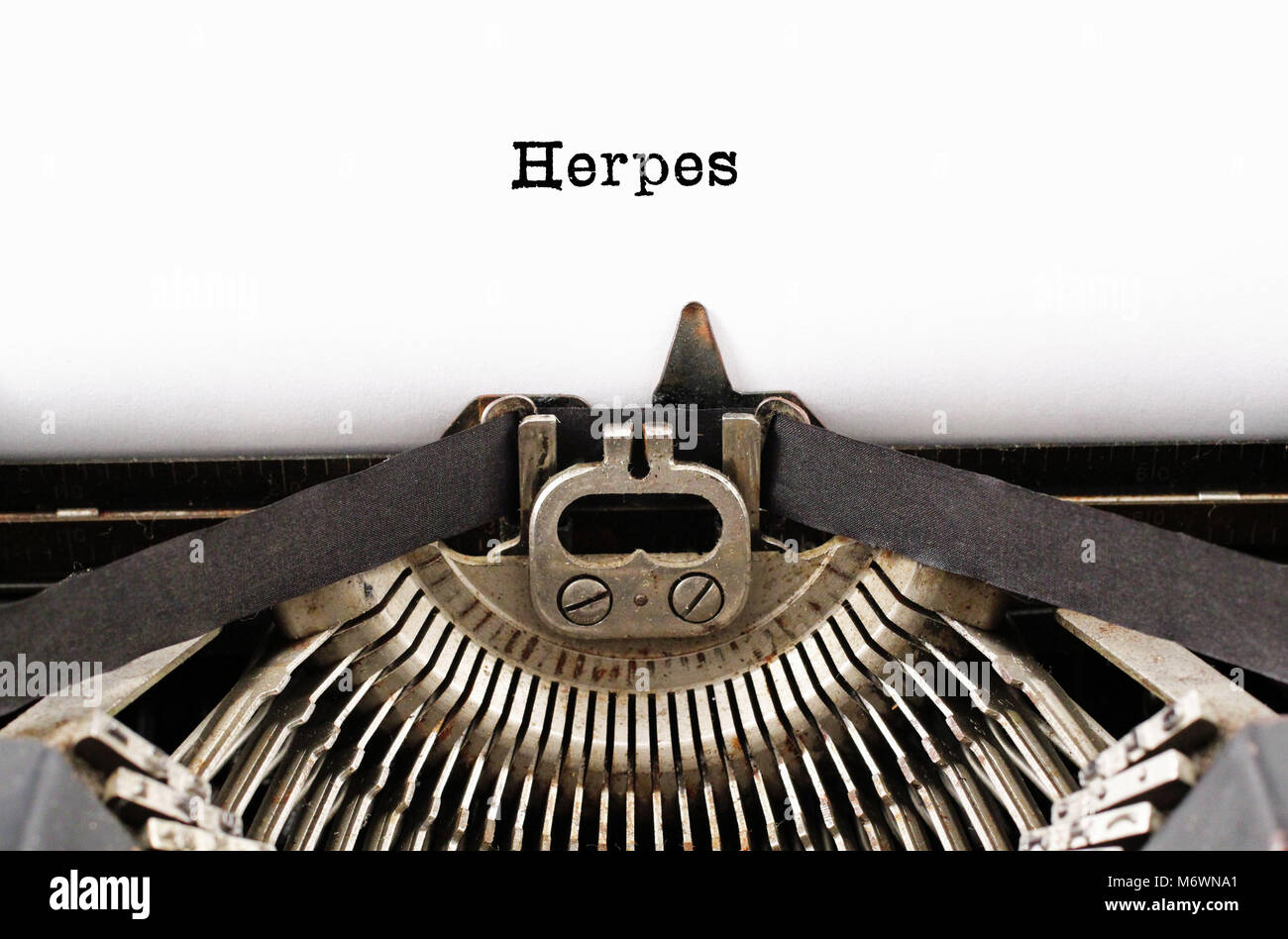 The word Herpes from a typewriter on a white background Stock Photo