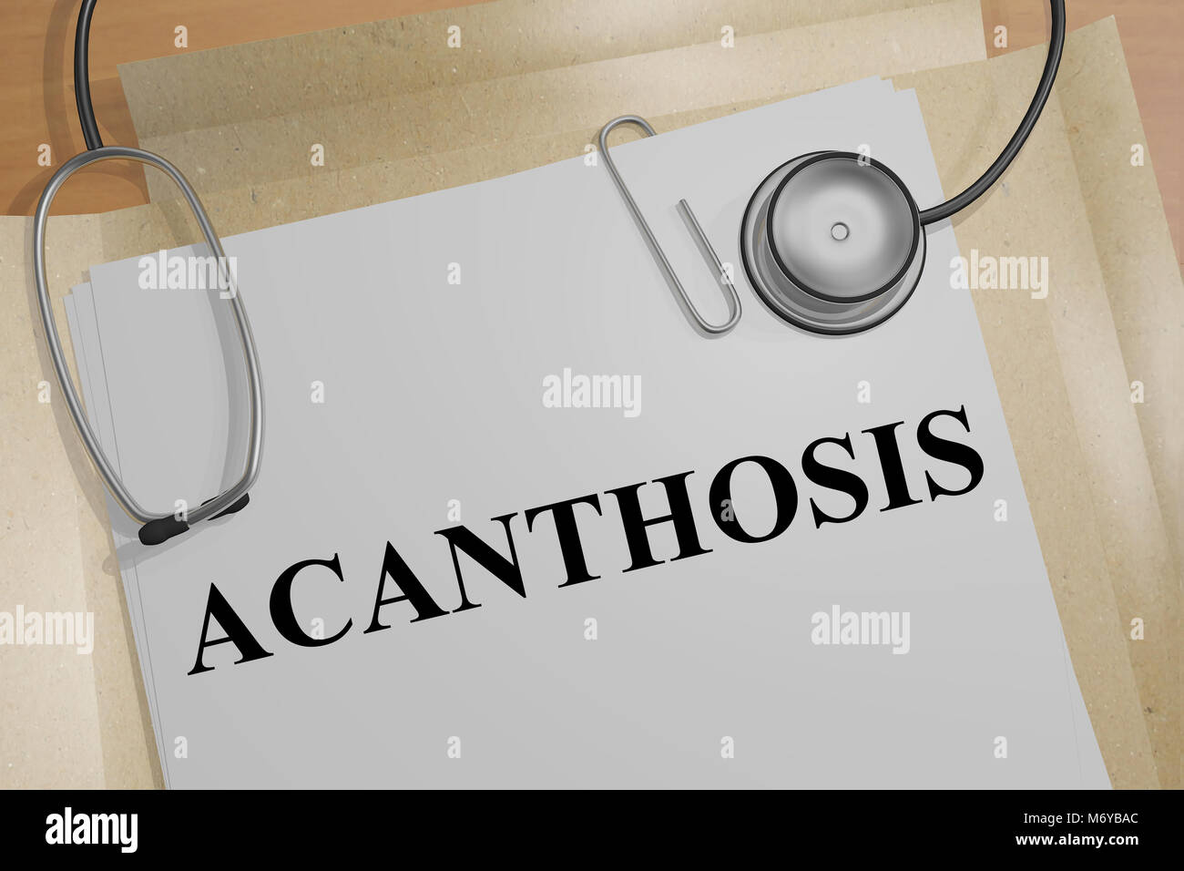 3D illustration of ACANTHOSIS title on a medical document Stock Photo
