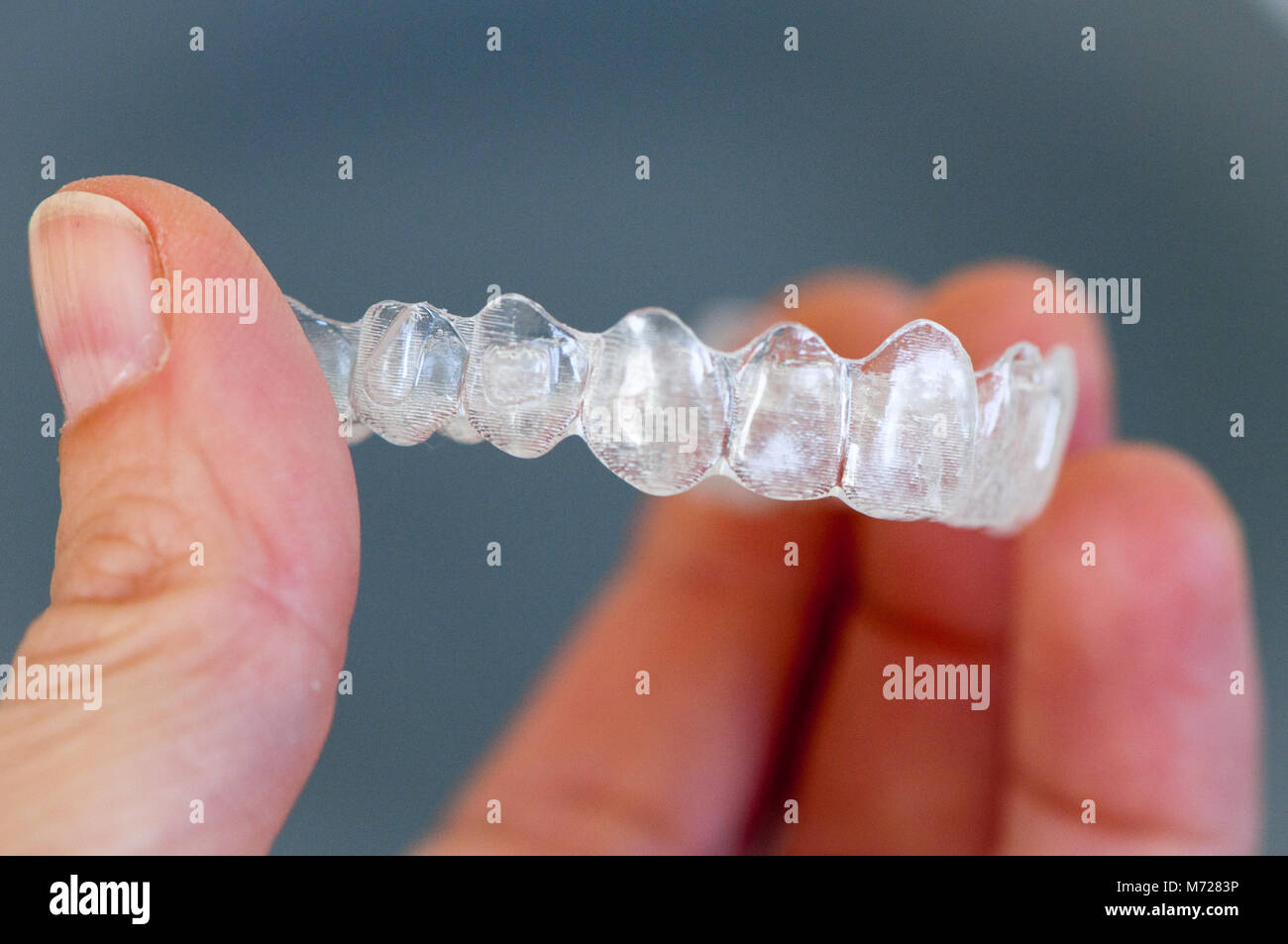 Hand holding invisible, plastic tooth brackets (orthodontic aligners) Stock Photo