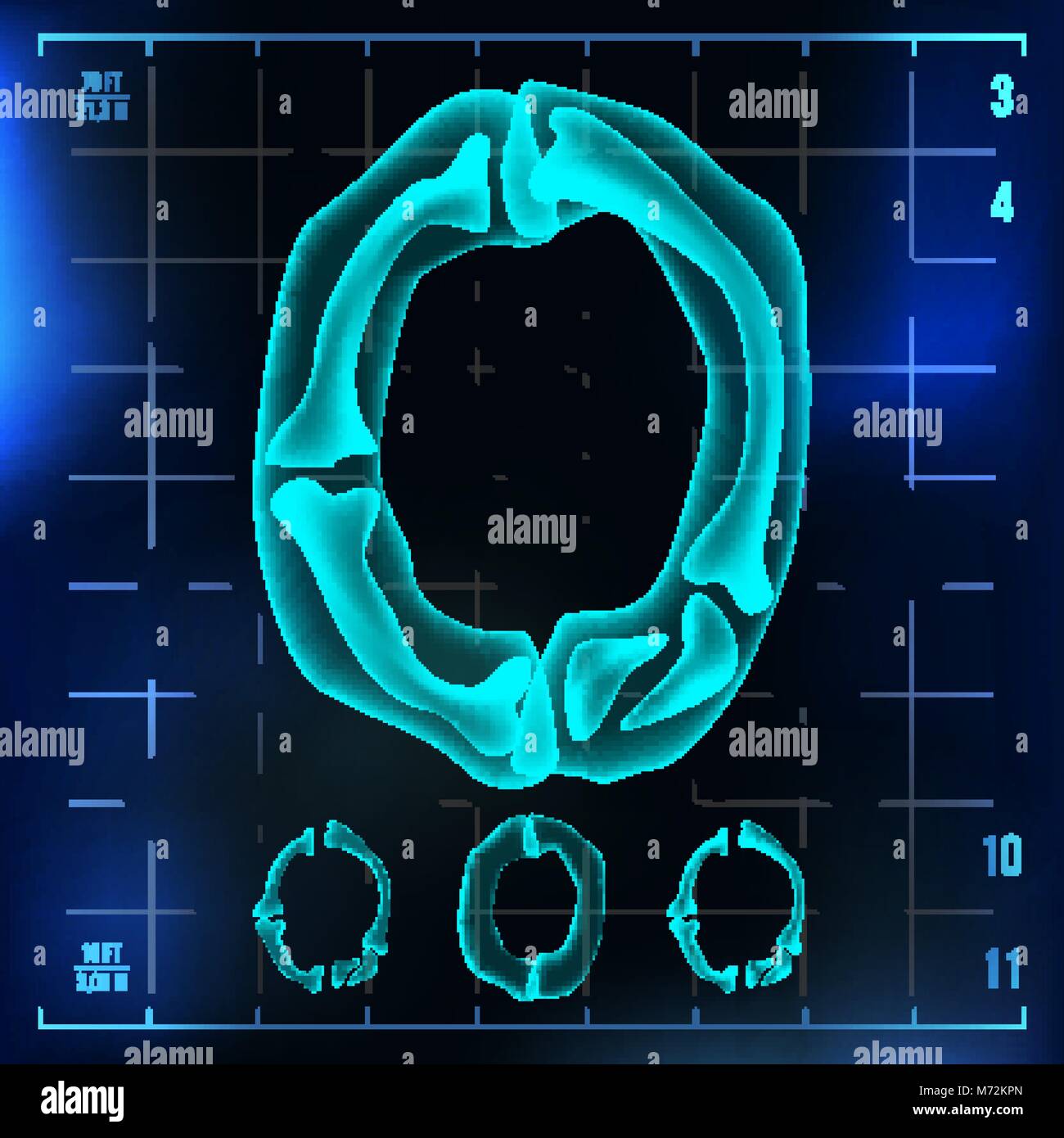 Neon Radiography 0 Number Vector. Zero Roentgen X-ray Font Light Sign. Medical Radiology ...