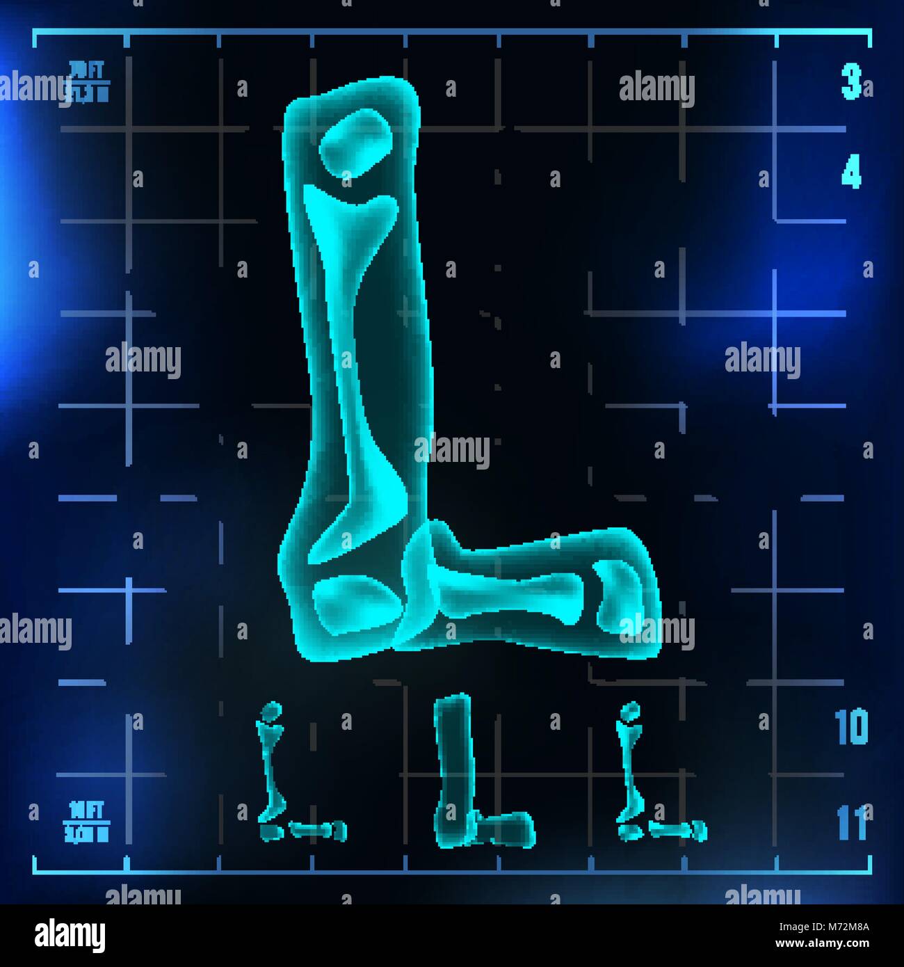 Neon Radiography X ray light board hi-res stock photography and images - Alamy