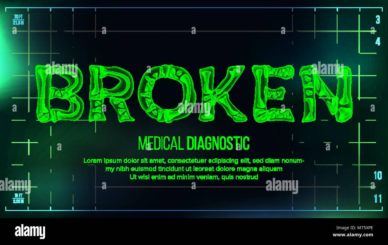Broken Banner Vector Medical Background Transparent Roentgen X