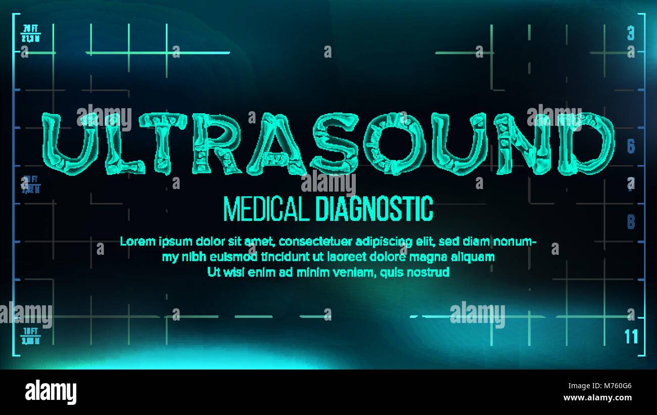 Ultrasound Banner Vector. Medical Background. Transparent Roentgen X-Ray Text With Bones. Radiology 3D Scan. Medical Health Typography. Futuristic Technology Illustration Stock Vector